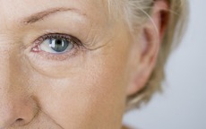 6 điều cần lưu ý khi dùng retinol ngừa lão hóa