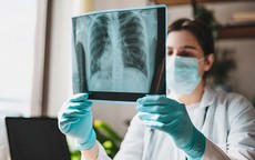 Chuyên gia cảnh báo nhóm người cần tầm soát ung thư phổi