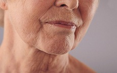 Thói quen làm hao hụt collagen, da nhanh lão hóa