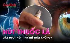 Sự thật về thông tin hút thuốc lá gây đục thủy tinh thể