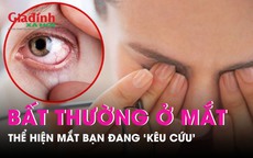 Bất thường nào thể hiện mắt bạn đang kêu cứu?