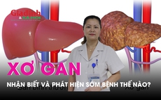 Nhận biết và phát hiện sớm bệnh xơ gan