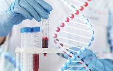 5 xét nghiệm không thể bỏ qua khi khám sức khỏe