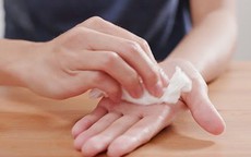 Cách ngăn ngừa ra mồ hôi tay, chân quá nhiều