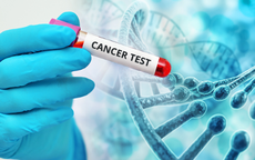 Có nên xét nghiệm gen để biết mình bị ung thư hay không?