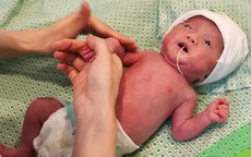 Hành trình kỳ diệu của em bé chào đời nặng 400g, lọt thỏm trong bàn tay bác sĩ