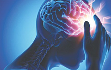 Không phải cứ đau đầu, chóng mặt… là dùng hoạt huyết dưỡng não