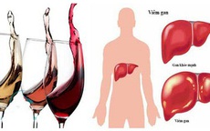 Uống rượu bia nhiều có nguy cơ mắc bệnh ung thư gì?