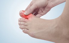 Cách phân biệt đau do mắc gout và viêm khớp dạng thấp