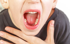 Điểm danh các bệnh lý nhiễm khuẩn tai mũi họng thường gặp và cách phòng ngừa