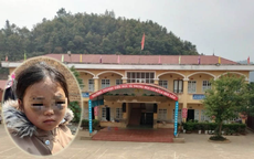 Công an vào cuộc làm rõ vụ bé gái lớp 1 nghi bị cô giáo đánh tím mắt ở Yên Bái