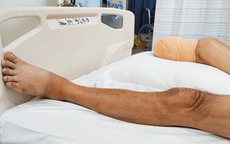 Người đàn ông mắc bệnh tiểu đường bất ngờ phải cắt cụt chân chỉ vì lấy khóe móng chân theo cách này