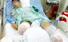 Nam sinh Vĩnh Phúc bị tai nạn mất đôi chân được xét đặc cách tốt nghiệp THPT