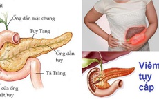 Người đàn ông ở Phú Thọ nhập viện gấp vì mỡ máu cao gấp 50 lần, bác sĩ khuyến cáo từ bỏ ngay thói quen này