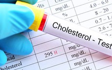 4 cách kiểm soát cholesterol máu để phòng ngừa bệnh tim mạch