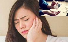 Uống thuốc bị tích nước ở mặt: Đây là cách xử lý an toàn nhất
