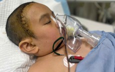 MS 1043: Xót thương hoàn cảnh bé gái mắc bệnh u não cần sự hỗ trợ từ cộng đồng