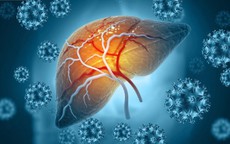 Người phụ nữ ở Hà Nội nhập viện vì viêm gan cấp thừa nhận một sai lầm nhiều người Việt mắc phải