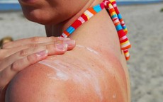 Tác hại của việc không dùng kem chống nắng
