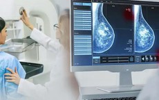 Phát hiện sớm ung thư vú nhờ ứng dụng AI trong chụp nhũ ảnh tầm soát