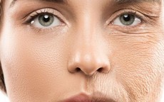 Kem chống nắng - tấm lá chắn chống lão hóa mùa hanh khô