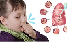 Ho kéo dài không khỏi, bé 20 tháng đi khám phát hiện viêm phổi không điển hình