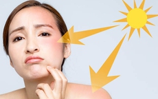 Đây là cách hấp thụ vitamin D mà không bị rám nắng