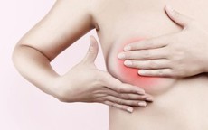 Cách kiểm tra phát hiện ung thư vú giai đoạn sớm