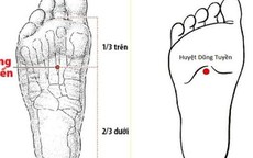 Bác sĩ y học cổ truyền khuyến cáo một số biện pháp phòng ngừa đột quỵ vào mùa lạnh