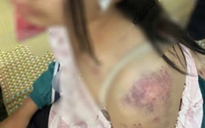 Góc pháp lý vụ bà nội bạo hành cháu gái ở Thái Nguyên