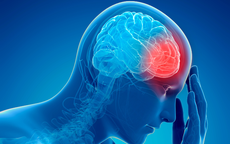 Người phụ nữ 59 tuổi bất ngờ phát hiện u màng não từ dấu hiệu nhiều người Việt bỏ qua