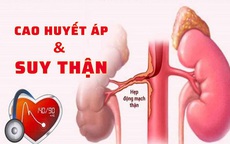 Huyết áp tăng cao, người phụ nữ 39 tuổi đi khám bất ngờ phát hiện nguy cơ mắc bệnh thận mạn