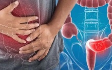 Người đàn ông phát hiện ung thư đại tràng từ dấu hiệu dễ bị nhầm lẫn, rất nhiều người Việt đã bỏ qua