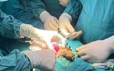 Bảo tồn thành công tinh hoàn bị xoắn cho thiếu niên đã qua 'thời gian vàng'