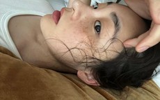 7 "tín hiệu SOS" khi cơ thể thiếu collagen trầm trọng, ăn thêm 5 món để bổ sung gấp!