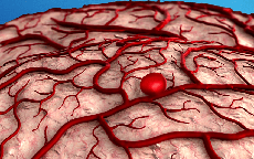 Người phụ nữ 46 tuổi phát hiện đột quỵ từ dấu hiệu cảnh báo sớm nhiều người Việt thường bỏ qua