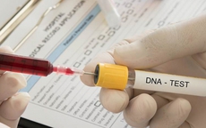 Cú lừa của người yêu cũ và phép thử lòng tin: Tôi ly hôn ngay khi có kết quả ADN