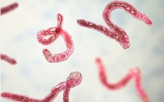 Người đàn ông 39 tuổi đột ngột phát hiện nhiễm sán não trong lần đi khám vì đau đầu