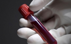 Con gái ngày càng giống người yêu cũ của vợ, tôi muốn xét nghiệm ADN