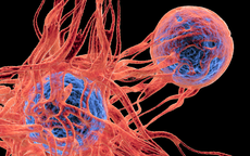 4 thực phẩm có đặc tính ngăn ngừa sự phát triển của tế bào ung thư, người Việt nên ăn nhiều hơn