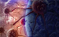 Tế bào ung thư 'thích' gì nhất? Cảnh báo 1 môi trường thuận lợi cho chúng phát triển