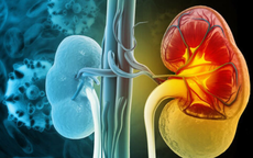 7 dấu hiệu suy thận giai đoạn đầu dễ nhận biết nhưng người Việt thường bỏ qua