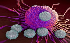 Loại rau được chuyên gia Mỹ nghiên cứu có khả năng ức chế tế bào ung thư, người Việt nên ăn thường xuyên