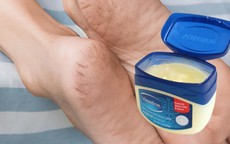 Cách khắc phục tình trạng da gót chân khô, nứt nẻ mùa đông