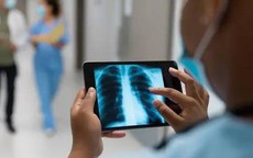 Những người có "phổi sạch" thường có 5 đặc điểm. Nếu bạn có 4 trong số đó, thì xin chúc mừng!