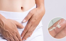 Cơ thể thừa đường sẽ phát ra 7 tín hiệu, thay đổi ngay để tránh mắc bệnh mãn tính và hụt collagen quá nhiều