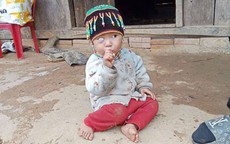 MS 1005: Bé 2 tuổi bị ung thư võng mạc, cha mẹ nghèo bán đàn lợn cũng không đủ tiền chữa trị