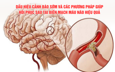 Dấu hiệu cảnh báo sớm và các phương pháp giúp hồi phục sau tai biến mạch máu não hiệu quả