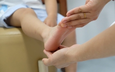 Sưng đau cổ chân phải sau khi chơi bóng rổ, tái phát nhiều lần, bé trai 11 tuổi được phát hiện có bàn chân bẹt hai bên