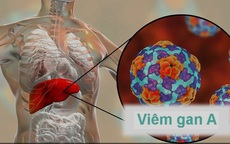Lưu ý 6 nhóm thực phẩm gây hại gan, không nên ăn để phòng bệnh viêm gan A